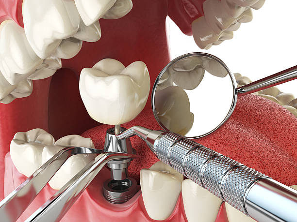 Best Emergency Treatment for Dental Infections or Abscesses in Tontitown, AR
