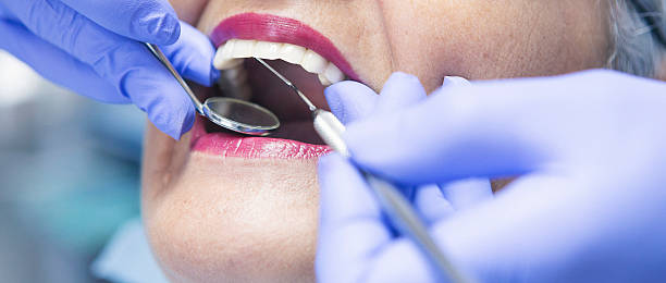 Best Emergency Tooth Extraction in Tontitown, AR